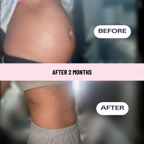 SnatchPatch™ - Bloat + Waistline Patches