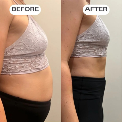 SnatchPatch™ - Bloat + Waistline Patches