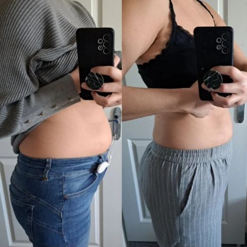 SnatchPatch™ - GLP-1 Peptide Patches