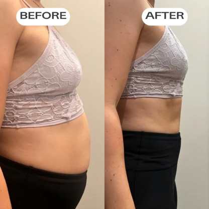 SnatchPatch™ - Bloat + Waistline Patches