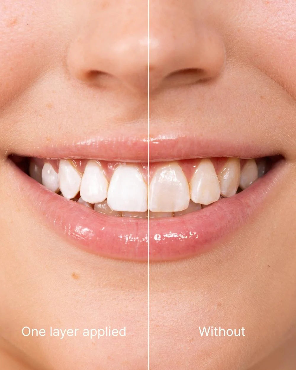 InstaWhite™ Teeth Polish - Instant White Teeth